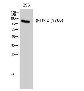 Fig. Western Blot analysis of 293 cells using Phospho-Trk B (Y706) Polyclonal Antibody diluted at 1:1000.
