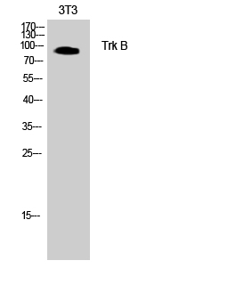 Fig.1. Western Blot analysis of rat brain cells using Trk B Polyclonal Antibody diluted at 1:500. Secondary antibody was diluted at 1:20000.