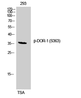 Fig. Western Blot analysis of 293 cells using Phospho-DOR-1 (S363) Polyclonal Antibody.