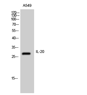 Fig. Western Blot analysis of A549 cells using IL-20 Polyclonal Antibody.