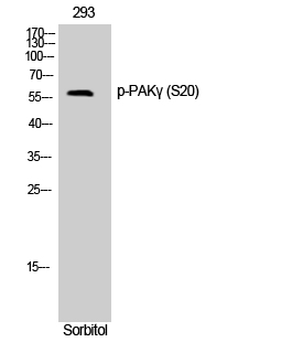 Fig. Western Blot analysis of 293 cells using Phospho-PAKγ (S20) Polyclonal Antibody.
