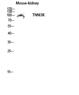 Fig. Western blot analysis of Mouse-kidney lysis using TNNI3K antibody. Antibody was diluted at 1:500. Secondary antibody was diluted at 1:20000.