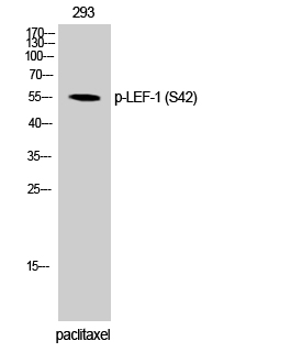 Fig. Western Blot analysis of 293 cells using Phospho-LEF-1 (S42) Polyclonal Antibody.