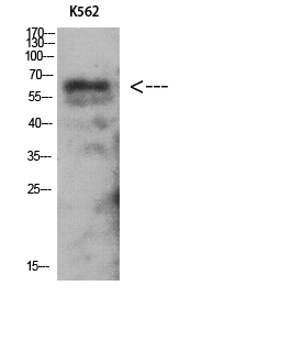 Fig. Western Blot analysis of K562 using Antibody diluted at 1:1000. Secondary antibody was diluted at 1:20000.