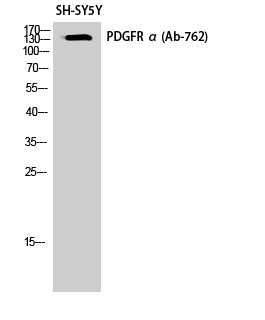 Fig. Western Blot analysis of SH-SY5Y cells using PDGFR-α Polyclonal Antibody.