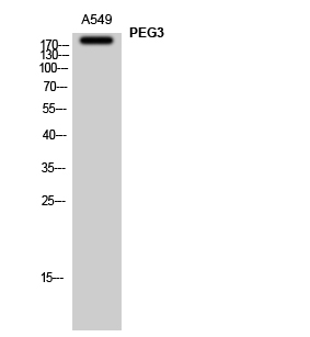 Fig. Western Blot analysis of A549 cells using PEG3 Polyclonal Antibody.