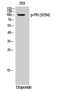 Fig. Western Blot analysis of 293 cells using Phospho-PR (S294) Polyclonal Antibody.