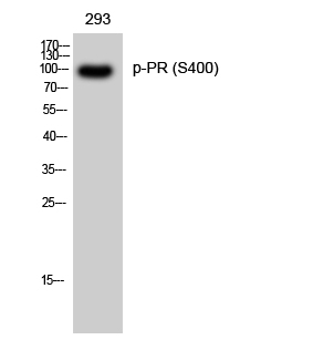 Fig. Western Blot analysis of 293 cells using Phospho-PR (S400) Polyclonal Antibody.