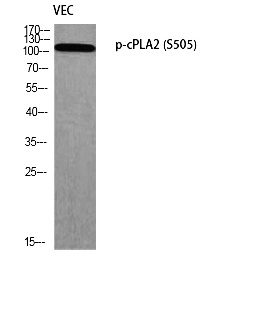 Fig. Western blot analysis of VEC using p-cPLA2 (S505) antibody. Antibody was diluted at 1:1000.