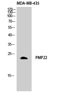 Fig. Western Blot analysis of MDA-MB-435 cells using GAS3 Polyclonal Antibody diluted at 1:1000.