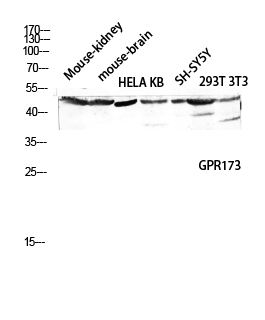 Fig.2. Western blot analysis of Mouse-kidney Mouse-brain HELA KB SH-SY5Y 293T 3T3 lysis using GPR173 antibody. Antibody was diluted at 1:2000.