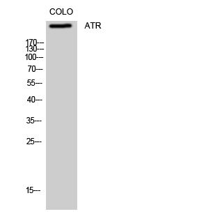 Fig. Western Blot analysis of COLO cells using ATR Polyclonal Antibody.