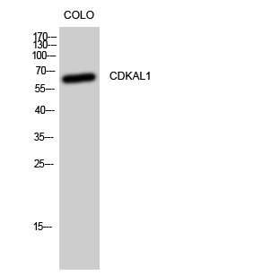 Fig. Western Blot analysis of CoLo cells using CDKAL1 Polyclonal Antibody.