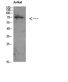 Fig. Western Blot analysis of Jurkat using Antibody diluted at 1:1000. Secondary antibody was diluted at 1:20000.