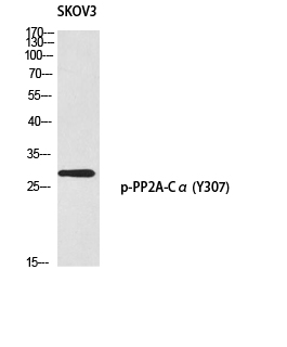Fig.1. Western blot analysis of SKOV3 using p-PP2A-Cα (Y307) antibody. Antibody was diluted at 1:1000.