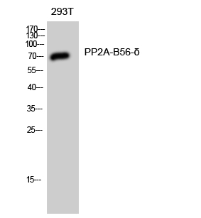 Fig. Western Blot analysis of 293T cells using PP2A-B56-δ Polyclonal Antibody diluted at 1:1000.