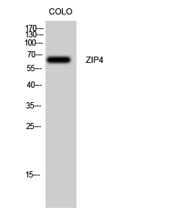 Fig. Western Blot analysis of Colo cells using ZIP4 Polyclonal Antibody. Secondary antibody was diluted at 1:20000.
