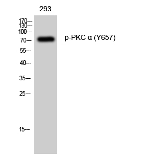 Fig. Western Blot analysis of 293 cells using Phospho-PKC α (Y657) Polyclonal Antibody diluted at 1:1000.
