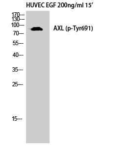 Fig. Western Blot analysis of HuvEc cells using Phospho-Axl (Y691) Polyclonal Antibody diluted at 1:500.
