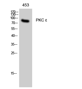 Fig. Western Blot analysis of 453 cells using PKC ε Polyclonal Antibody diluted at 1:500.