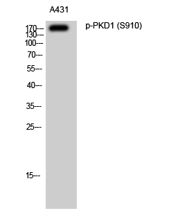 Fig. Western Blot analysis of A431 cells using Phospho-PKD1 (S910) Polyclonal Antibody.