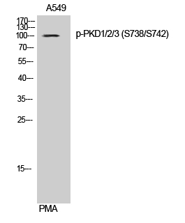 Fig. Western Blot analysis of A549 cells using Phospho-PKD1/2/3 (S738/S742) Polyclonal Antibody.