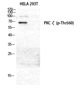 Fig. Western Blot analysis of HELA 293T cells using Phospho-PKC ζ (T560) Polyclonal Antibody diluted at 1:2000.