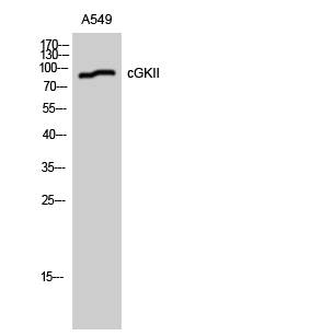 Fig.1. Western Blot analysis of A549 cells using cGKII Polyclonal Antibody diluted at 1:1000.