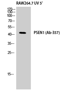 Fig. Western Blot analysis of RAW264.7 UV 5' cells using Presenilin 1 Polyclonal Antibody.