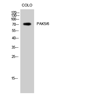 Fig. Western Blot analysis of COLO cells using PAK5/6 Polyclonal Antibody.