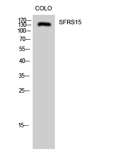 Fig. Western Blot analysis of COLO cells using SFRS15 Polyclonal Antibody diluted at 1:2000.