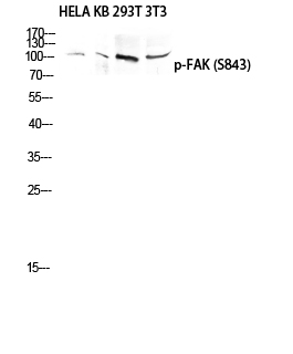 Fig.1. Western blot analysis of HELA KB 293T 3T3 lysis using Phospho-FAK (S843) antibody. Antibody was diluted at 1:1000.