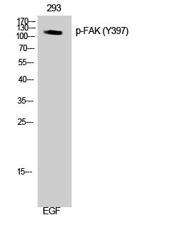 Fig.2. Western Blot analysis of 293 cells using Phospho-FAK (Y397) Polyclonal Antibody.