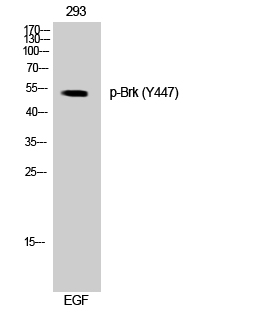 Fig. Western Blot analysis of 293 cells using Phospho-Brk (Y447) Polyclonal Antibody.