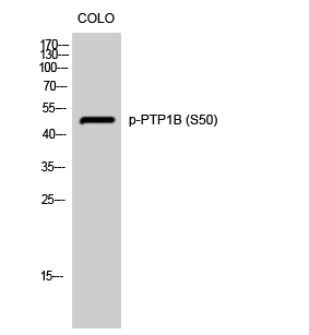 Fig. Western Blot analysis of COLO cells using Phospho-PTP1B (S50) Polyclonal Antibody diluted at 1:500.