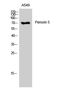 Fig. Western Blot analysis of A549 cells using Peroxin 5 Polyclonal Antibody.