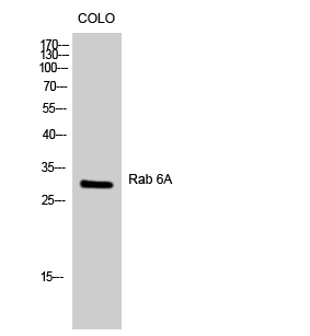 Fig.1. Western Blot analysis of COLO cells using Rab 6A Polyclonal Antibody diluted at 1:1000.