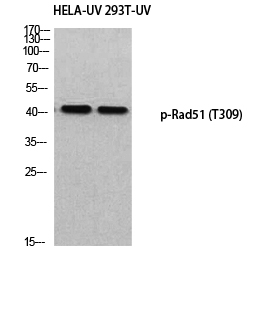 Fig. Western blot analysis of HELA-UV 293T-UV using p-Rad51 (T309) antibody. Antibody was diluted at 1:500.