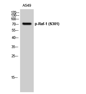 Fig.1. Western Blot analysis of A549 cells using Phospho-Raf-1(S301) Polyclonal Antibody diluted at 1:1000.