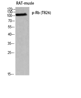 Fig. Western blot analysis of RAT-musle using p-Rb (T826) antibody. Antibody was diluted at 1:500.
