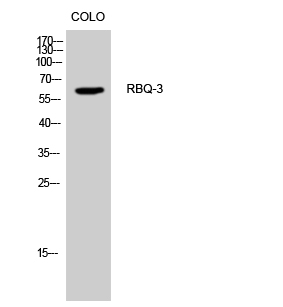 Fig. Western Blot analysis of CoLo cells using RBQ-3 Polyclonal Antibody.