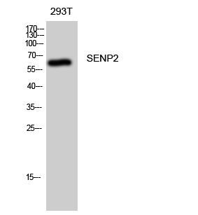 Fig. Western Blot analysis of 293T cells using SENP2 Polyclonal Antibody diluted at 1:1000.