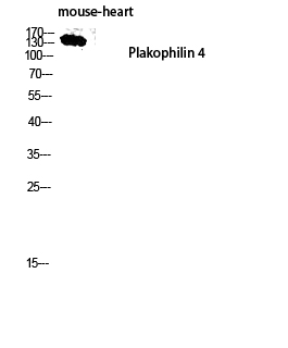 Fig. Western blot analysis of Mouse-heart lysis using Plakophilin 4 antibody. Antibody was diluted at 1:2000.