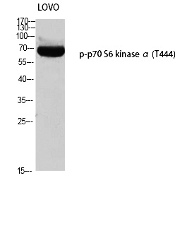 Fig. Western blot analysis of LOVO using p-p70 S6 kinase α (T444) antibody. Antibody was diluted at 1:500.