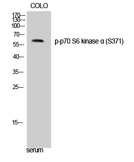 Fig. Western Blot analysis of COLO cells using Phospho-p70 S6 kinase α (S371) Polyclonal Antibody diluted at 1:500.