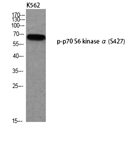 Fig. Western blot analysis of K562 using p-p70 S6 kinase α (S427) antibody.