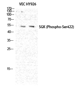 Fig. Western Blot analysis of VEC HY926 cells using Phospho-SGK1 (S422) Polyclonal Antibody diluted at 1:500.