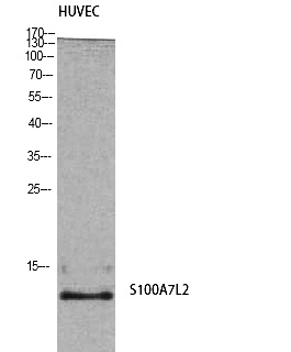 Fig. Western Blot analysis of HuvEc cells using S-100A7L2 Polyclonal Antibody.