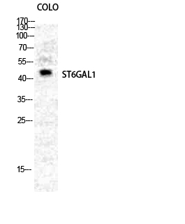 Fig. Western Blot analysis of COLO cells using CD75 Polyclonal Antibody diluted at 1:2000.