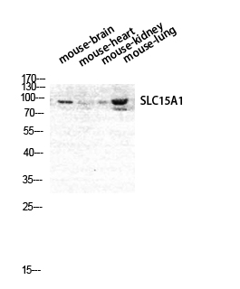 Fig. Western Blot analysis of Mouse-BRAIN Mouse-HEART Mouse-LUNG Mouse-KIDNEY cells using PEPT1 Polyclonal Antibody diluted at 1:1000.